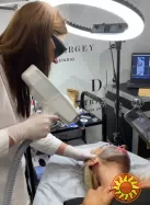 Лазерний Карбоновий пілінг